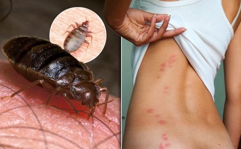 Cách xử lý triệt để tránh bị rệp giường đốt